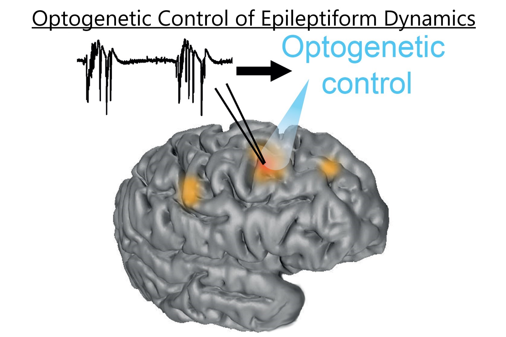 Project 5. Optogenetic Control of Epileptiform Dynamics 